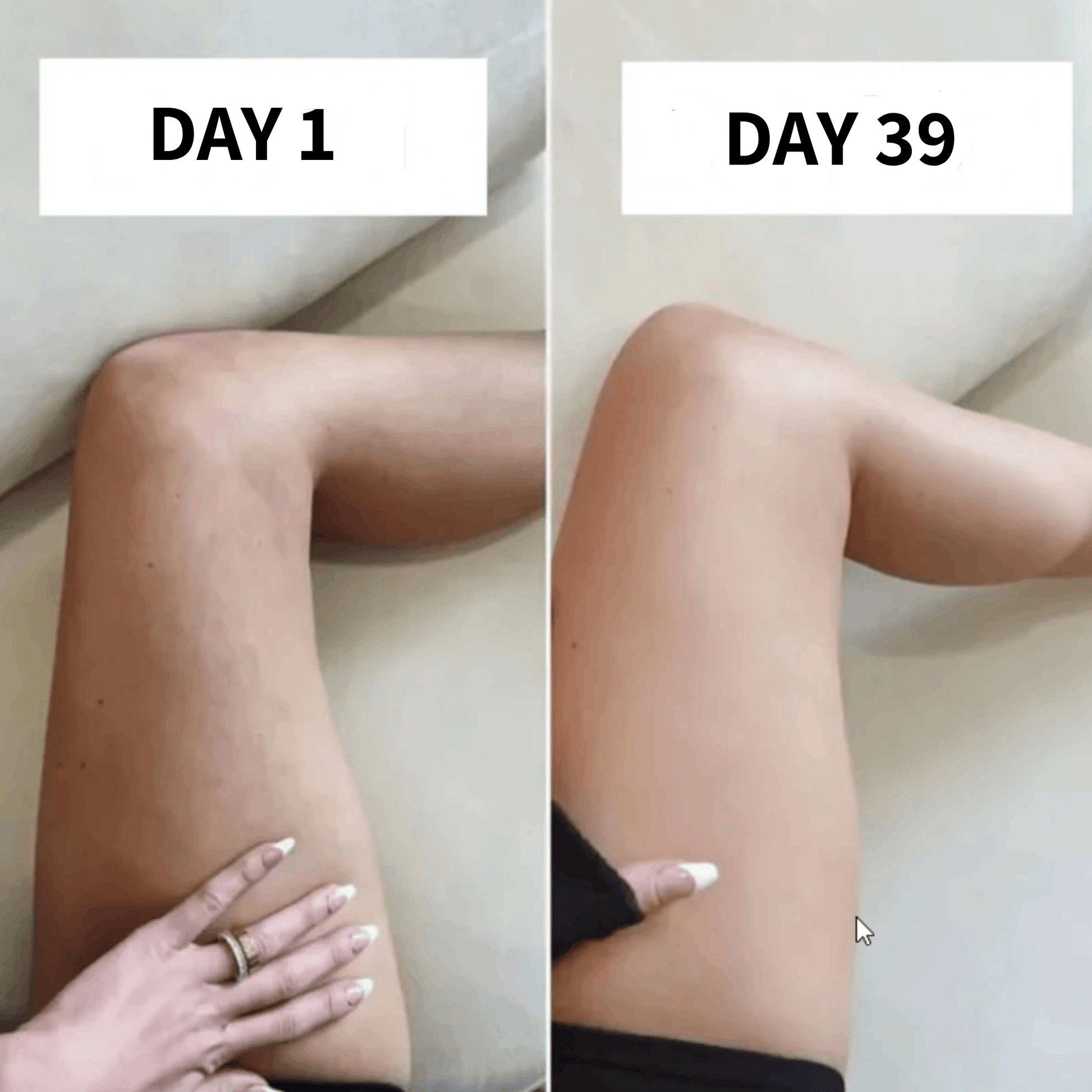Cellulite Removal Wand - Mavens Deals